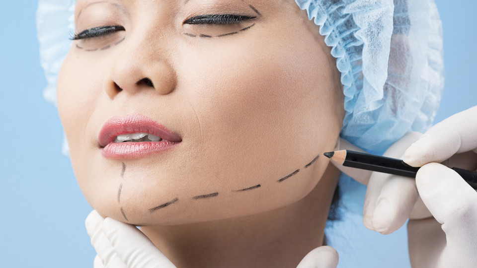 Profiloplastie m&eacute;dicale chirurgicale nez menton visage
