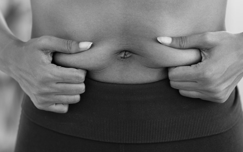Remodelage de la silhouette body contouring chirurgie