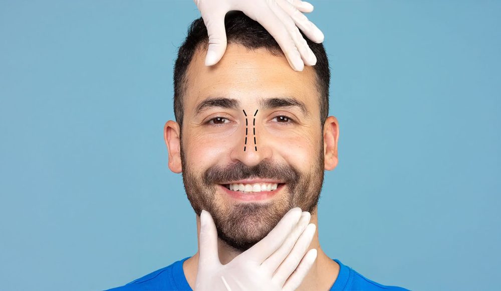 Rhinoplastie pour homme nez masculin chirurgie ultrasonique