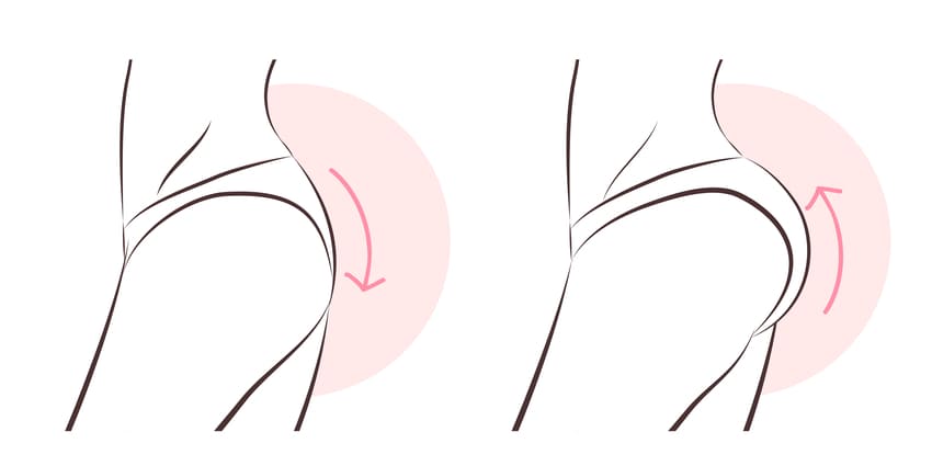 Augmentation des fesses