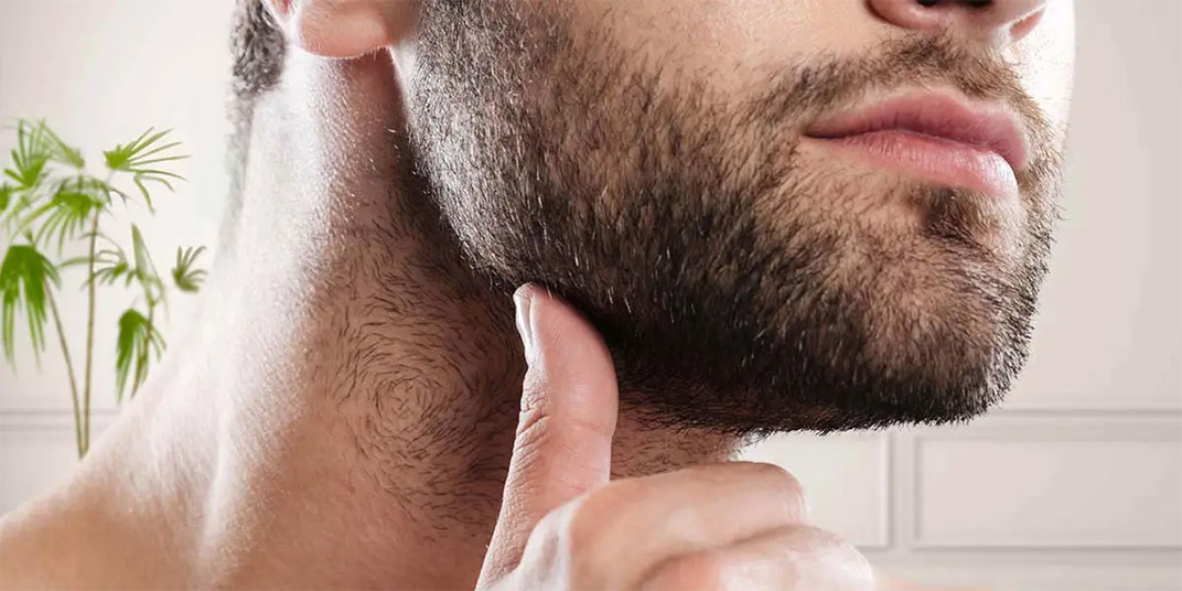 Greffe de barbe